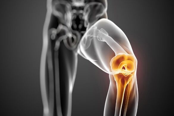 Kniegelenks -Osteoarthritis
