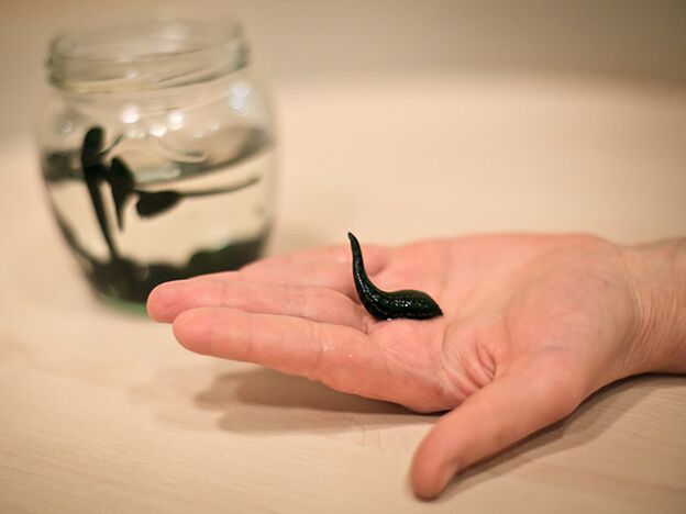 Anwendung zur Behandlung von Arthrose des Kniegelenks.